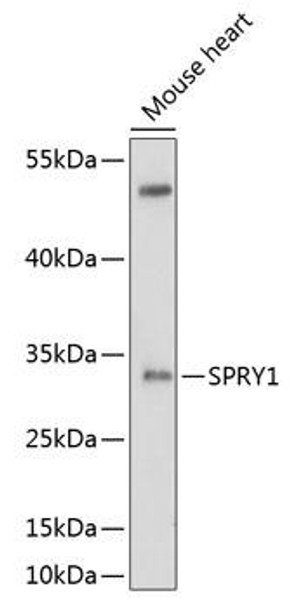 Cell Biology Antibodies 1 Anti-SPRY1 Antibody CAB10278