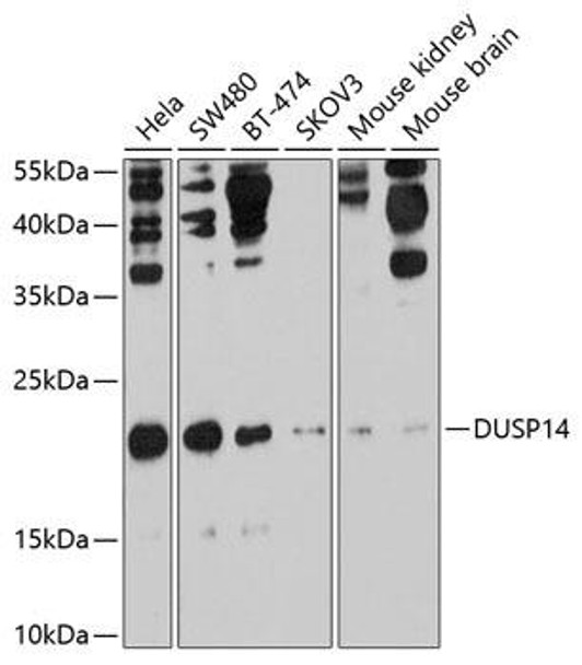 Cell Biology Antibodies 1 Anti-DUSP14 Antibody CAB10287