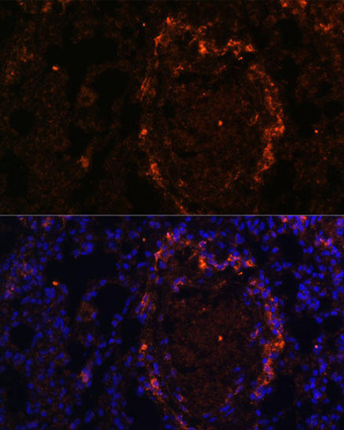 Immunology Antibodies 1 Anti-BTN3A1 Antibody CAB10288