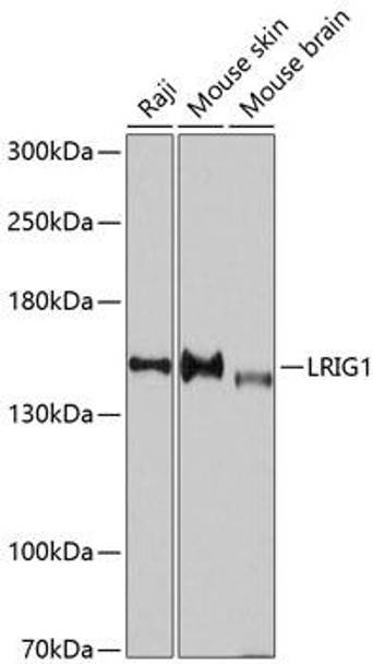 Cell Biology Antibodies 1 Anti-LRIG1 Antibody CAB10297