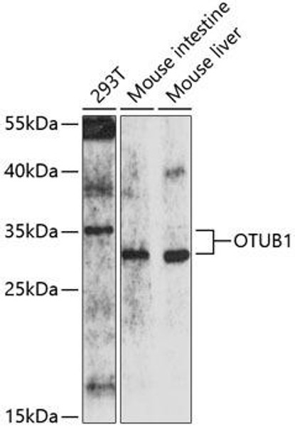 Immunology Antibodies 1 Anti-OTUB1 Antibody CAB10313