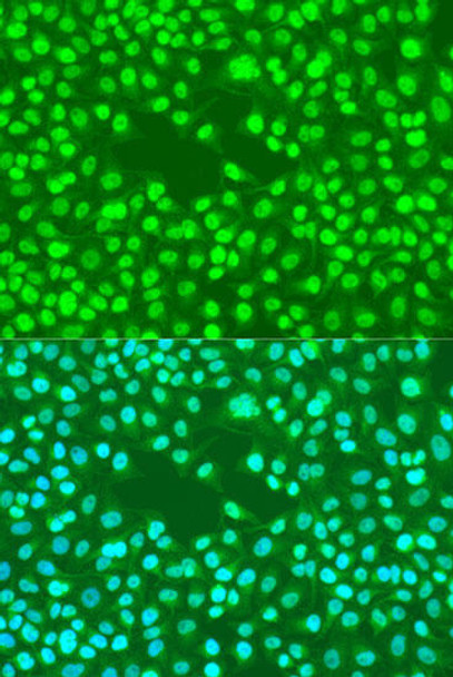 Epigenetics and Nuclear Signaling Antibodies 1 Anti-Rad23B Antibody CAB1034