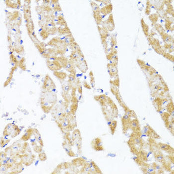 Cell Biology Antibodies 1 Anti-EGLN1/EGLN2 Antibody CAB10342