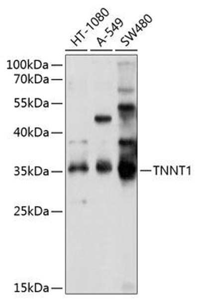 Cell Biology Antibodies 1 Anti-TNNT1 Antibody CAB10354