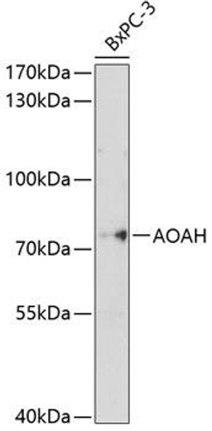 Metabolism Antibodies 1 Anti-AOAH Antibody CAB10366