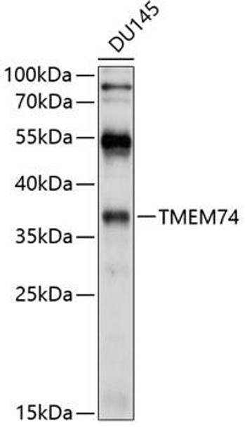 Autophagy Antibodies Anti-TMEM74 Antibody CAB10379