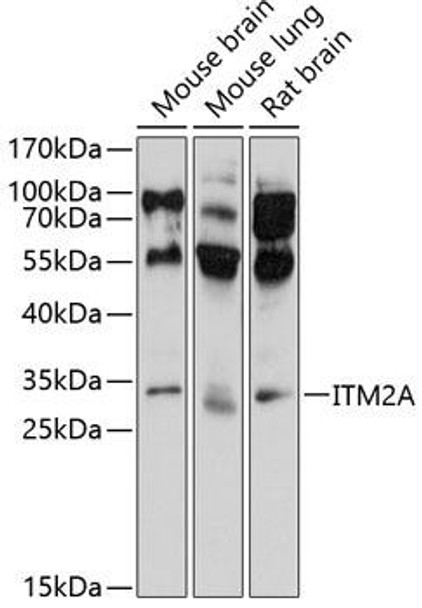 Cell Biology Antibodies 1 Anti-ITM2A Antibody CAB10385