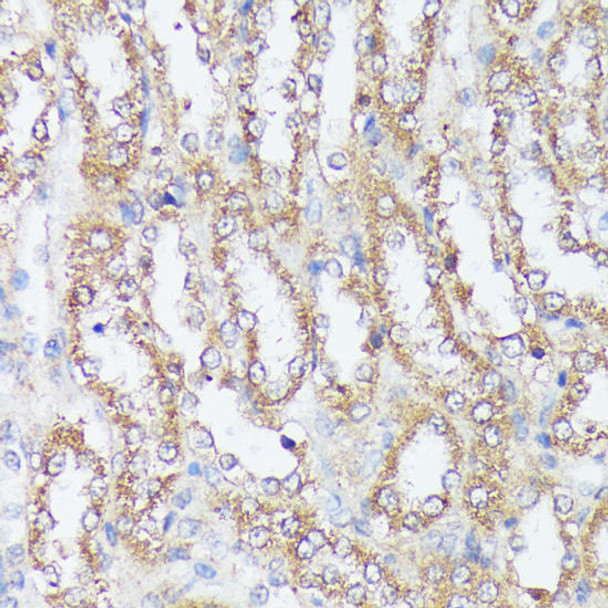 Metabolism Antibodies 1 Anti-MTHFD2 Antibody CAB10386