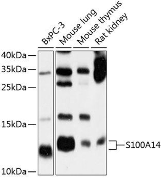 Cell Death Antibodies 1 Anti-S100A14 Antibody CAB10394
