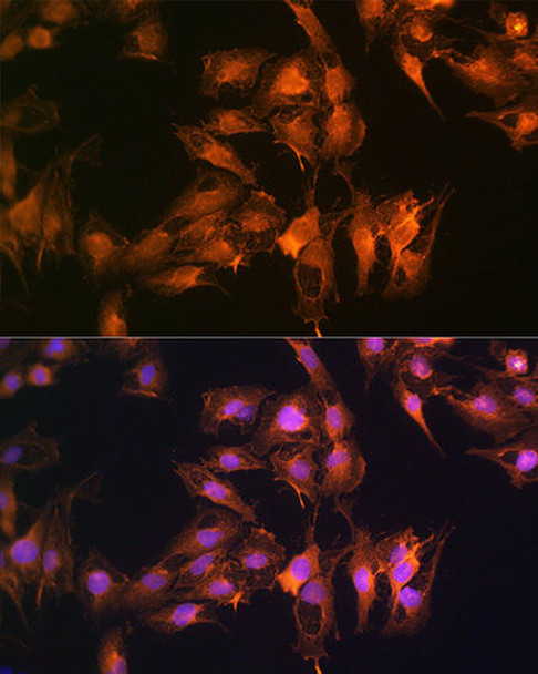 Cell Death Antibodies 1 Anti-S100A14 Antibody CAB10394