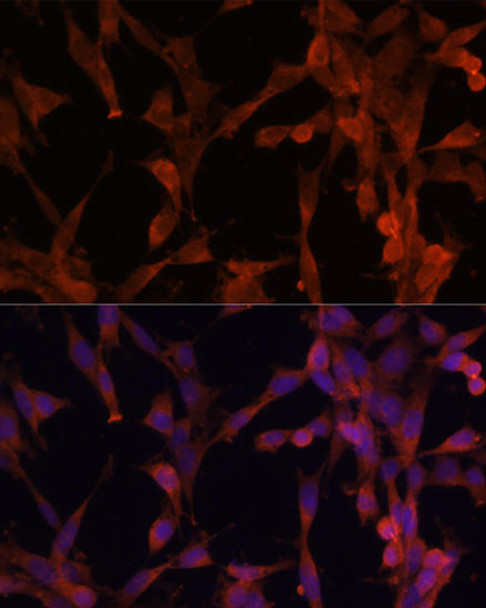 Signal Transduction Antibodies 1 Anti-UBE2G2 Antibody CAB10408