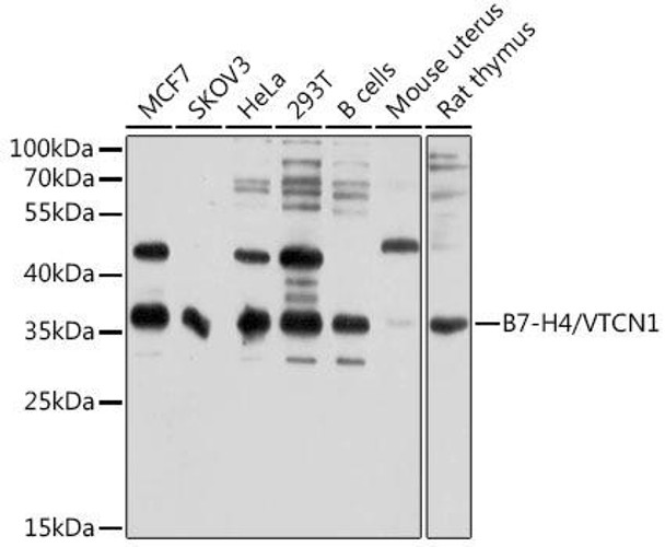 Immunology Antibodies 1 Anti-B7-H4/VTCN1 Antibody CAB10412