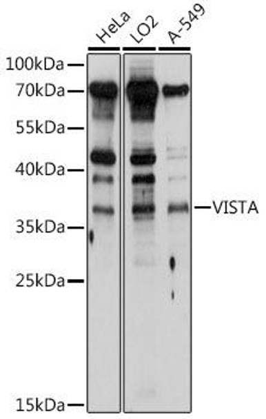 Signal Transduction Antibodies 1 Anti-VISTA Antibody CAB10419