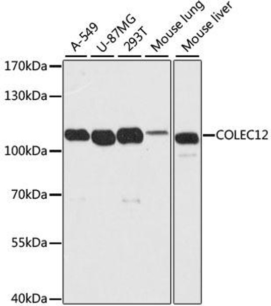 Cell Biology Antibodies 1 Anti-COLEC12 Antibody CAB10422