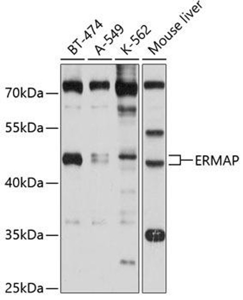 Cell Biology Antibodies 1 Anti-ERMAP Antibody CAB10425