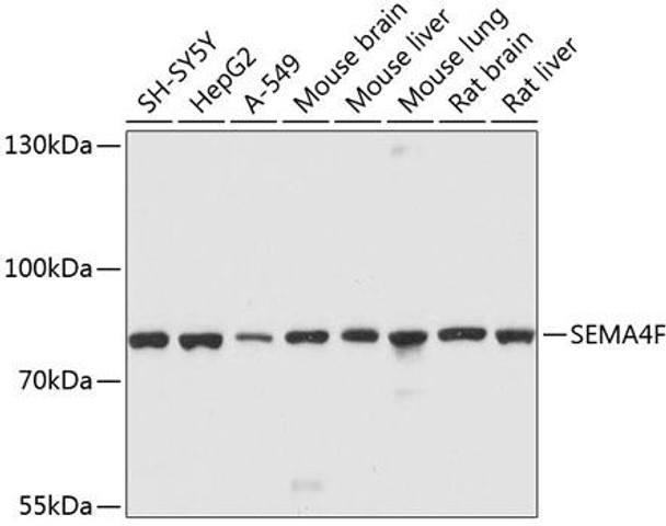 Developmental Biology Anti-SEMA4F Antibody CAB10432