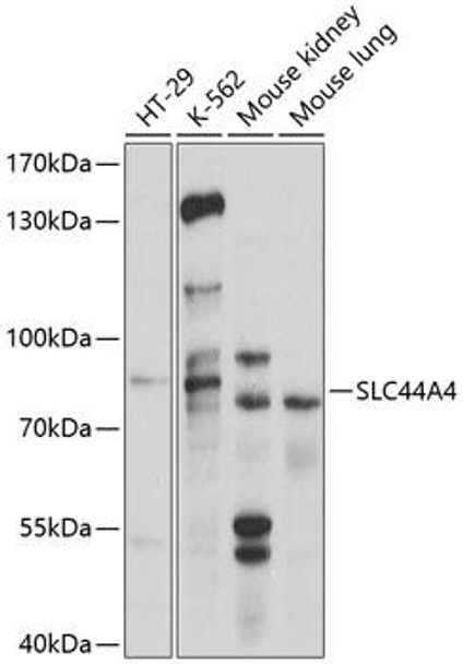 Cell Biology Antibodies 1 Anti-SLC44A4 Antibody CAB10435