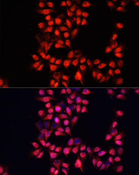 Signal Transduction Antibodies 1 Anti-ADAM10 Antibody CAB10438