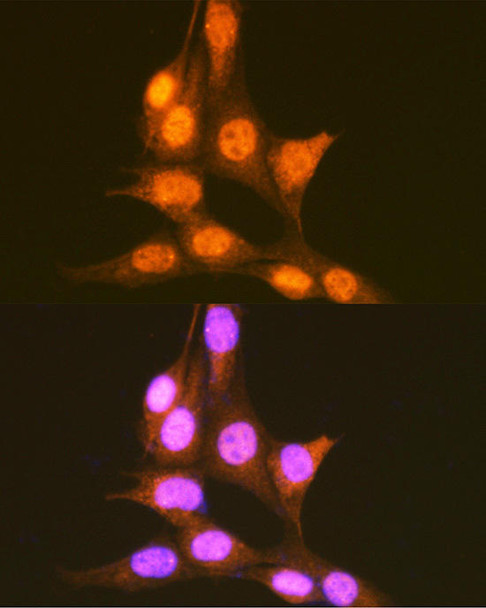 Epigenetics and Nuclear Signaling Antibodies 1 Anti-PCBP1 Antibody CAB1044