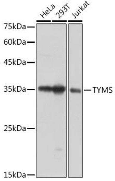 Epigenetics and Nuclear Signaling Antibodies 1 Anti-TYMS Antibody CAB10441