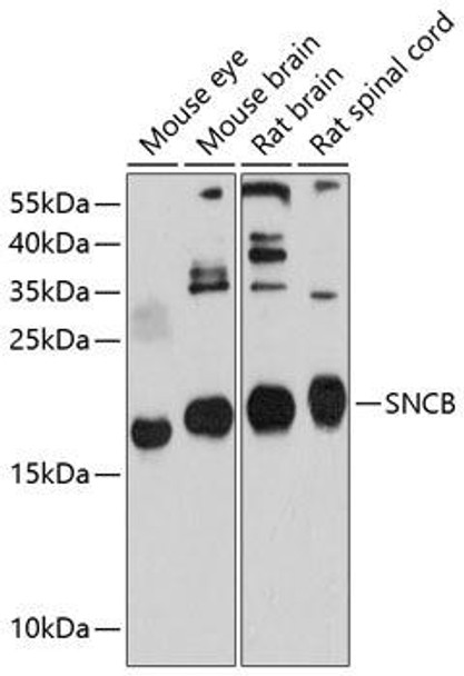 Cell Biology Antibodies 1 Anti-SNCB Antibody CAB10443