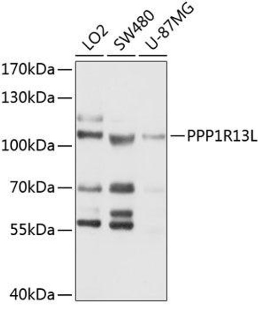 Cell Death Antibodies 1 Anti-PPP1R13L Antibody CAB10462