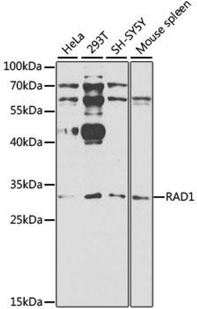Epigenetics and Nuclear Signaling Antibodies 1 Anti-RAD1 Antibody CAB1047