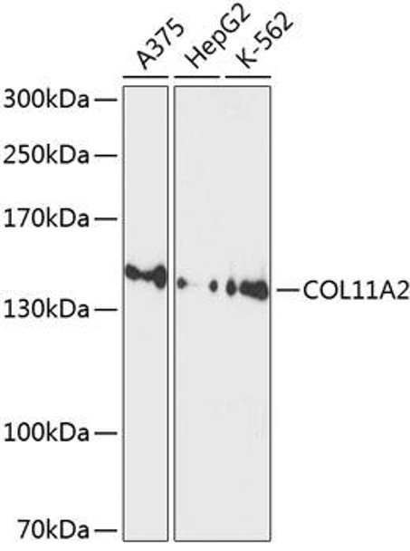 Cell Biology Antibodies 1 Anti-COL11A2 Antibody CAB10473