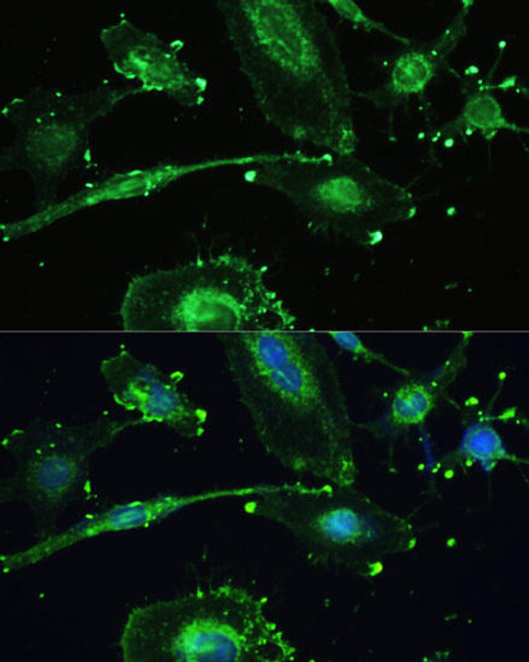 Cell Biology Antibodies 1 Anti-TREM2 Antibody CAB10482