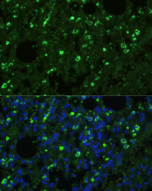 Cell Biology Antibodies 1 Anti-TREM2 Antibody CAB10482