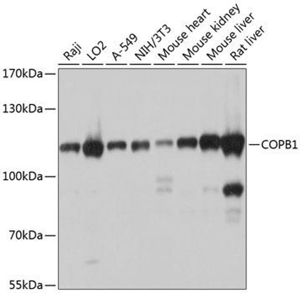 Cell Biology Antibodies 1 Anti-COPB1 Antibody CAB10485
