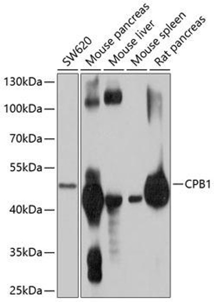 Cell Biology Antibodies 1 Anti-CPB1 Antibody CAB10486