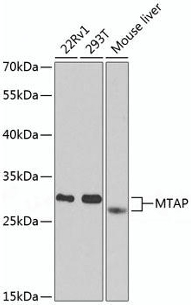 Metabolism Antibodies 1 Anti-MTAP Antibody CAB1049