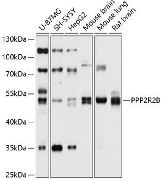 Cell Death Antibodies 1 Anti-PPP2R2B Antibody CAB10494