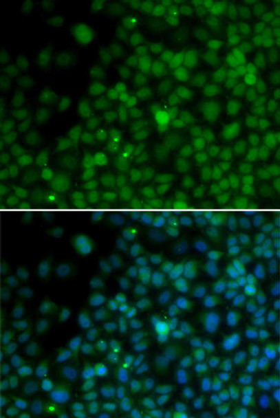 Epigenetics and Nuclear Signaling Antibodies 1 Anti-IRF4 Antibody CAB1052