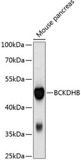 Cell Biology Antibodies 2 Anti-BCKDHB Antibody CAB10533