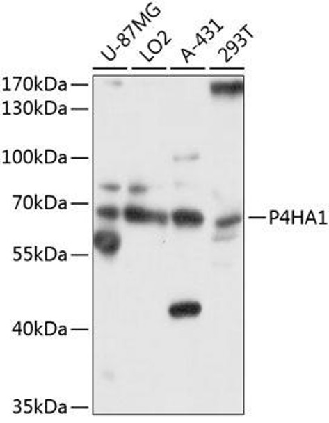 Cell Biology Antibodies 2 Anti-P4HA1 Antibody CAB10538