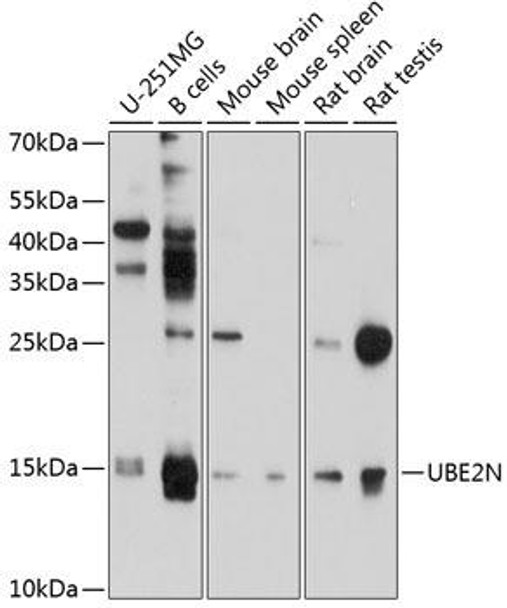 Epigenetics and Nuclear Signaling Antibodies 1 Anti-UBE2N Antibody CAB10543