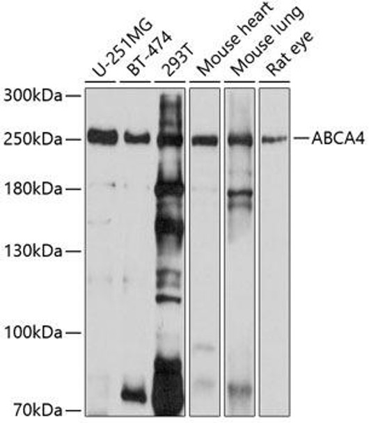 Signal Transduction Antibodies 1 Anti-ABCA4 Antibody CAB10556