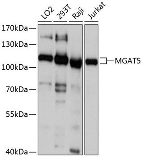 Cell Biology Antibodies 2 Anti-MGAT5 Antibody CAB10567
