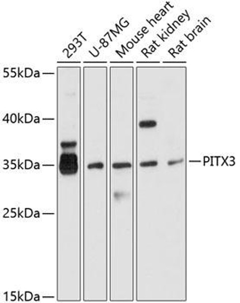 Epigenetics and Nuclear Signaling Antibodies 1 Anti-PITX3 Antibody CAB10569