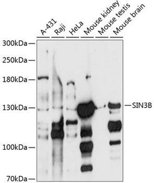 Epigenetics and Nuclear Signaling Antibodies 1 Anti-SIN3B Antibody CAB10584