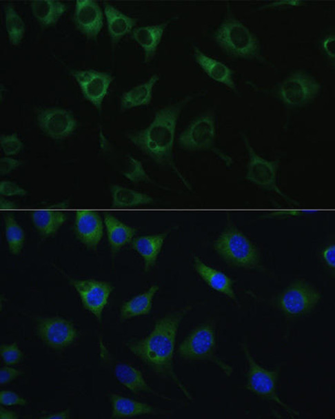 Cell Biology Antibodies 2 Anti-SRPRB Antibody CAB10591