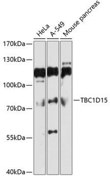 Cell Biology Antibodies 2 Anti-TBC1D15 Antibody CAB10593