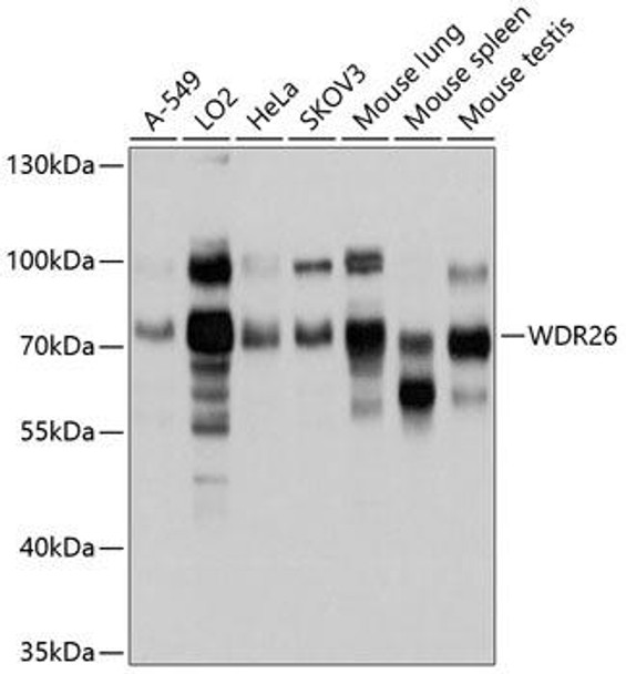 Cell Biology Antibodies 2 Anti-WDR26 Antibody CAB10594