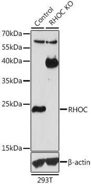 KO Validated Antibodies 1 Anti-RHOC Antibody CAB1062KO Validated
