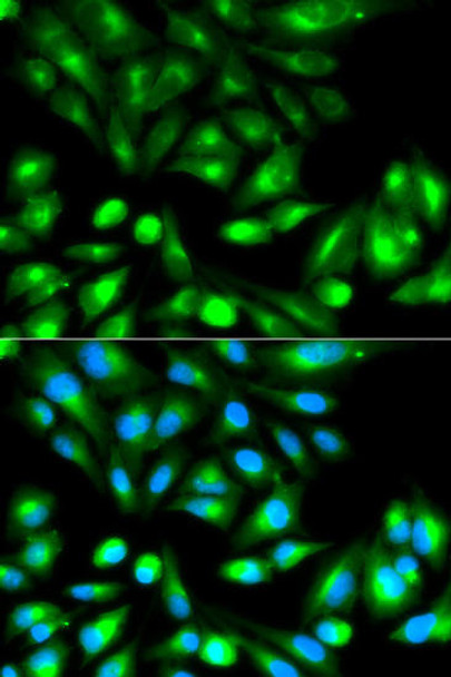 KO Validated Antibodies 1 Anti-RHOC Antibody CAB1062KO Validated