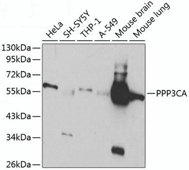 Cell Biology Antibodies 2 Anti-PPP3CA Antibody CAB1063