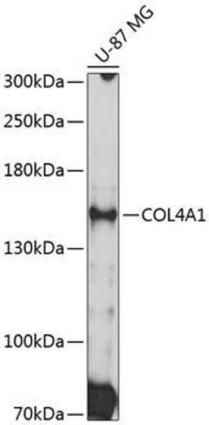 Cardiovascular Antibodies Anti-COL4A1 Antibody CAB10710