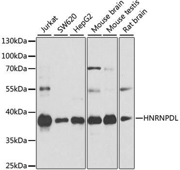 Epigenetics and Nuclear Signaling Antibodies 1 Anti-HNRNPDL Antibody CAB10721